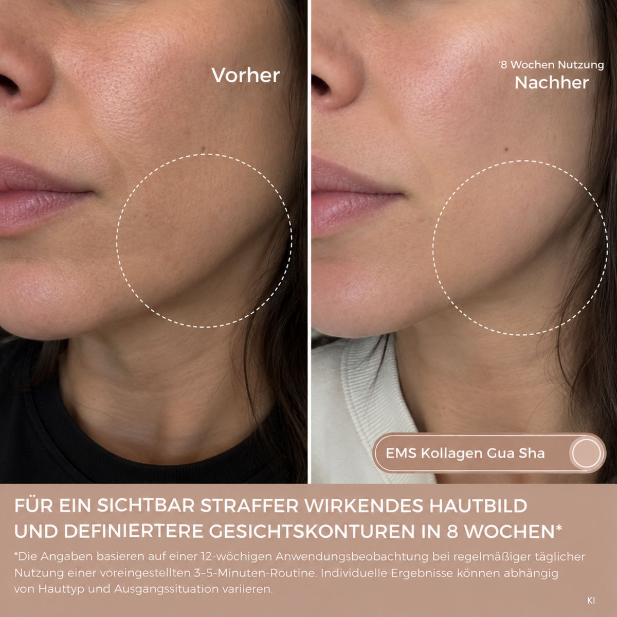 EMS Kollagen Gua Sha