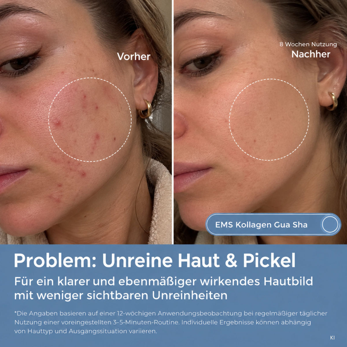 EMS Kollagen Gua Sha