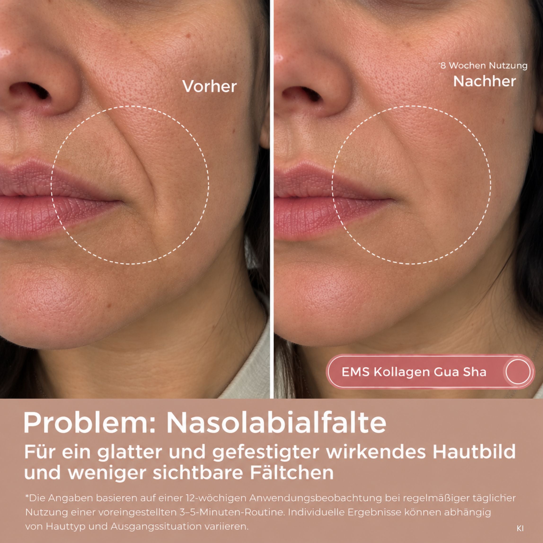 EMS Kollagen Gua Sha