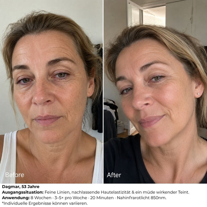 LED vs Kollagen Kapseln