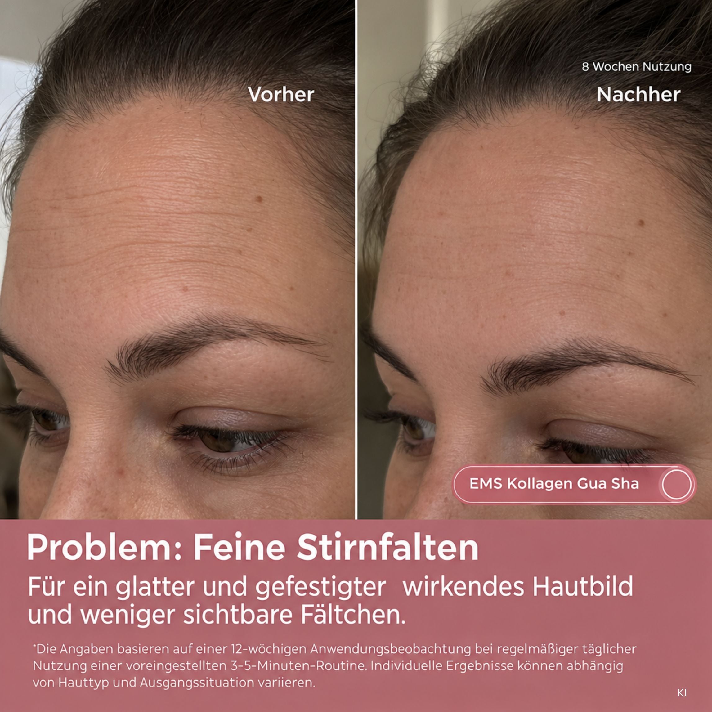 EMS Kollagen Gua Sha