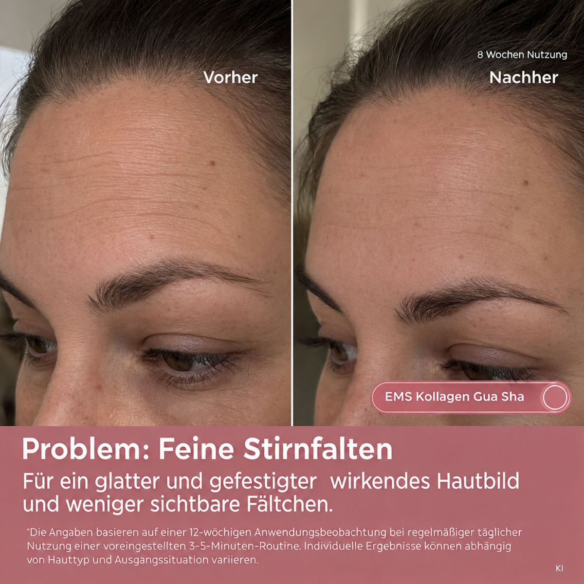 EMS Kollagen Gua Sha