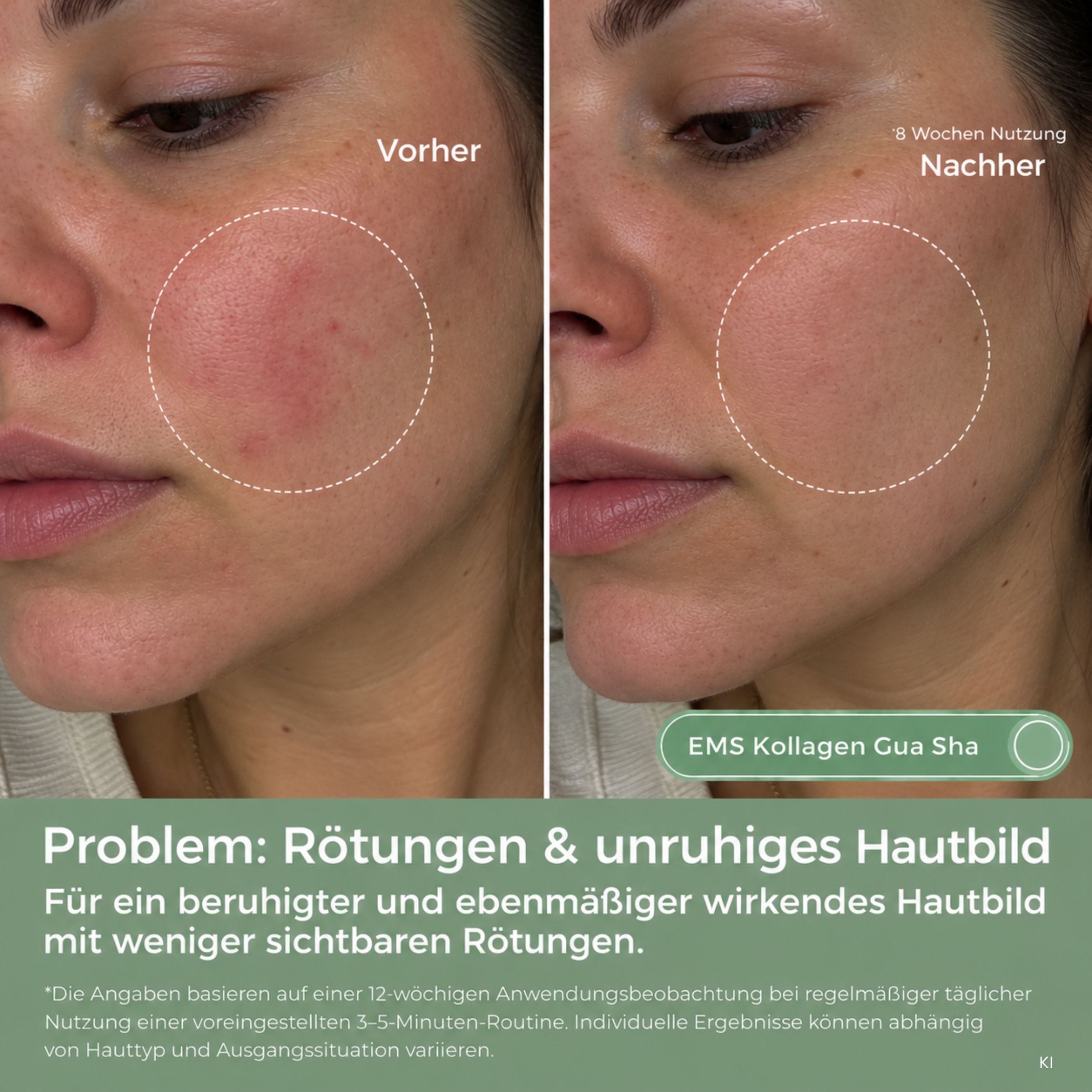EMS Kollagen Gua Sha